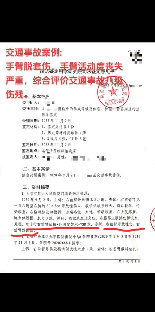 工伤伤残等级鉴定报告官方样本