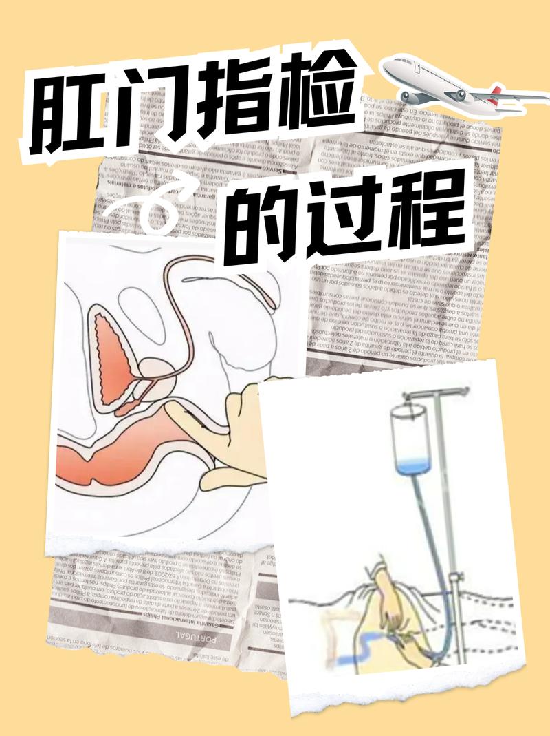 宠物医生给小型犬做肛门腺检查的标准操作示意图
