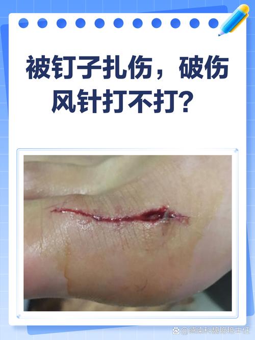 扎破几个常见的误解