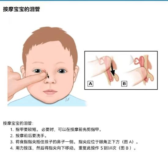 宝宝泪道按摩清洁操作示意图