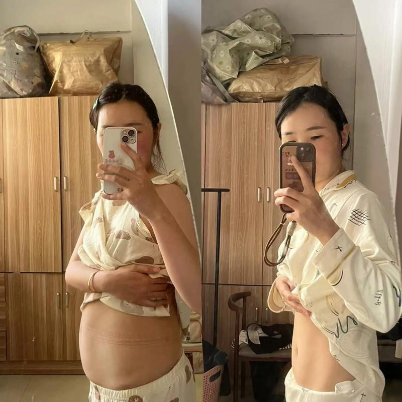 产后妈妈腹部恢复对比图