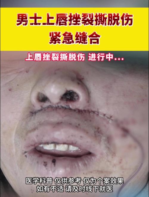 那些撕开裂缝的人