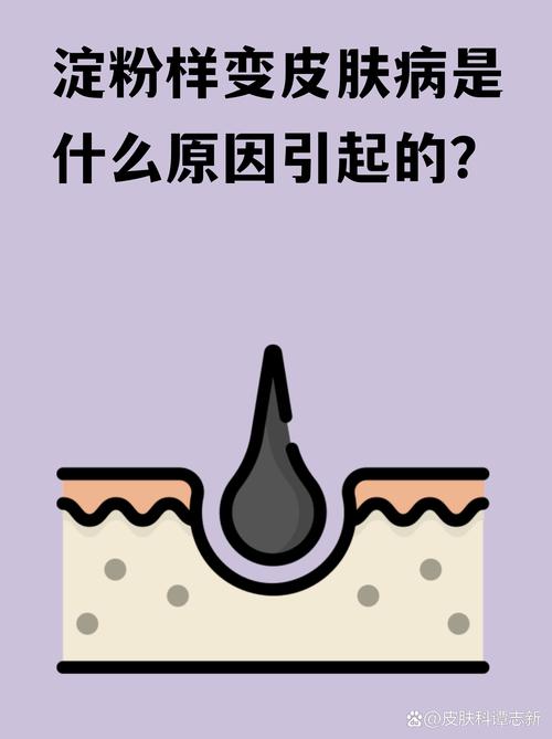 淀粉样蛋白战役：从怀疑到曙光