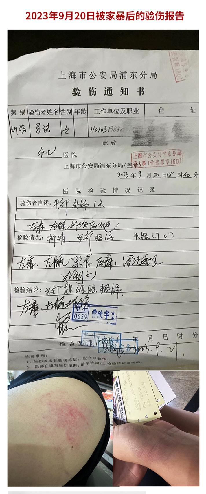 家庭暴力报警记录和验伤单照片
