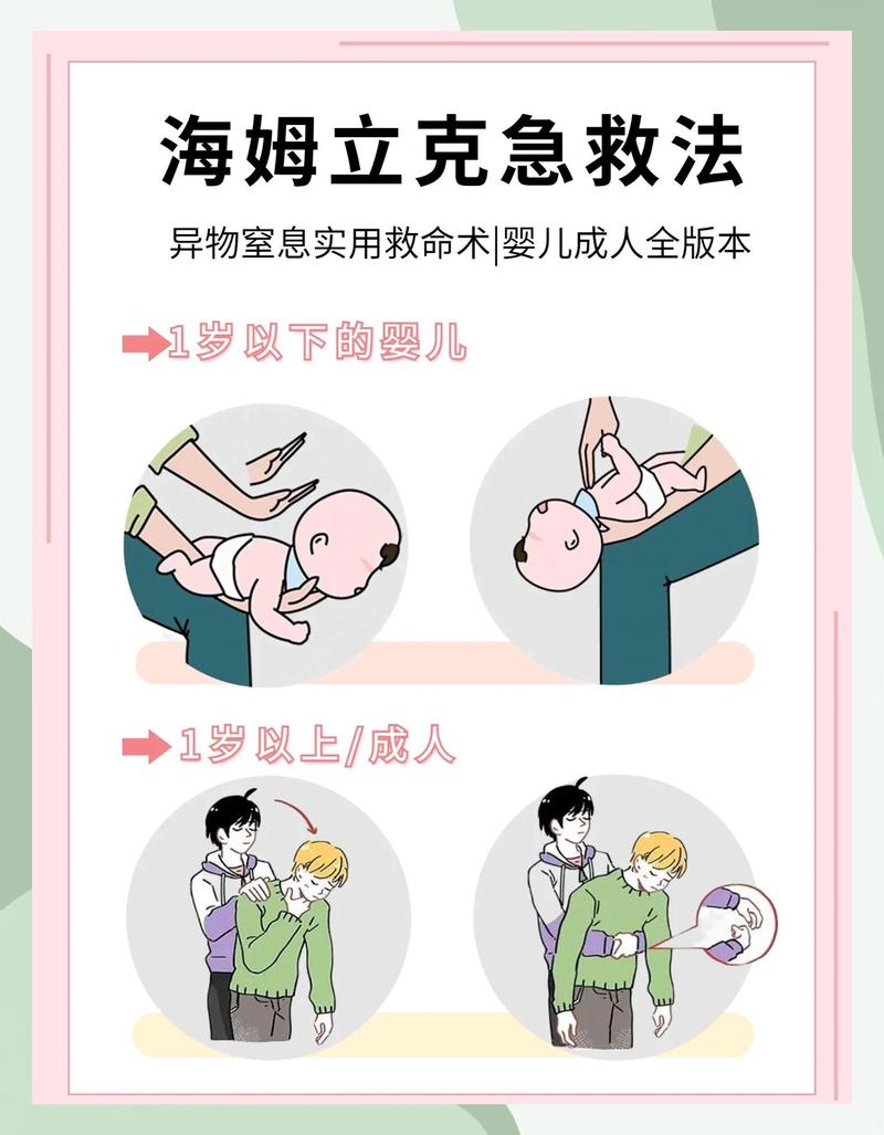 成人气道异物卡住海姆立克操作示意图