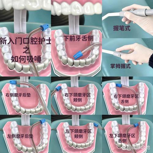 牙周炎患者口腔牙缝清洁示意图