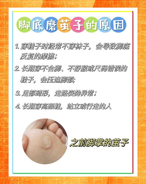 老茧死皮别瞎折腾