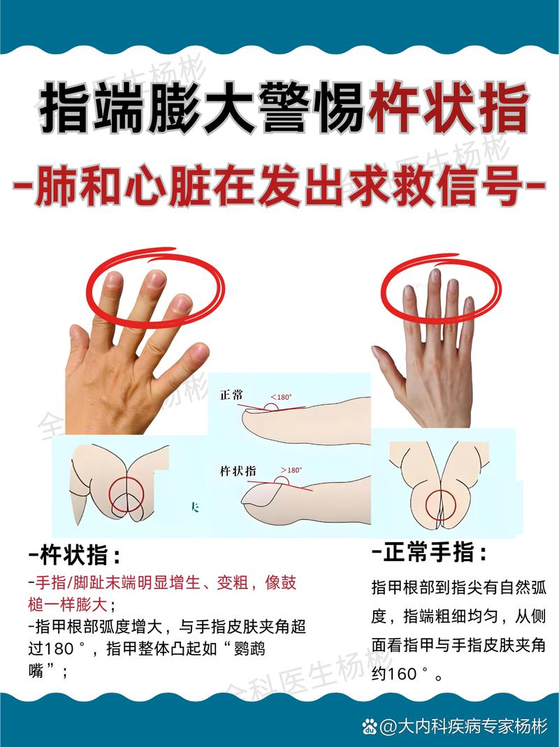 手指也是肉长的，别往死里用