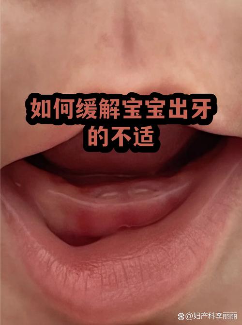 这些和宝宝出牙不适混在一起的信号,真的不能硬扛