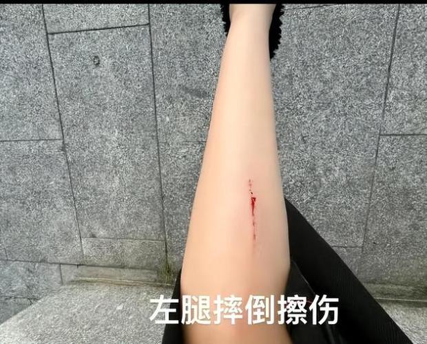 被“走”字绊了一跤