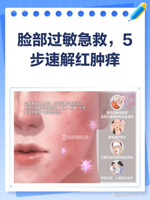 真怀疑过敏了，该怎么应对？