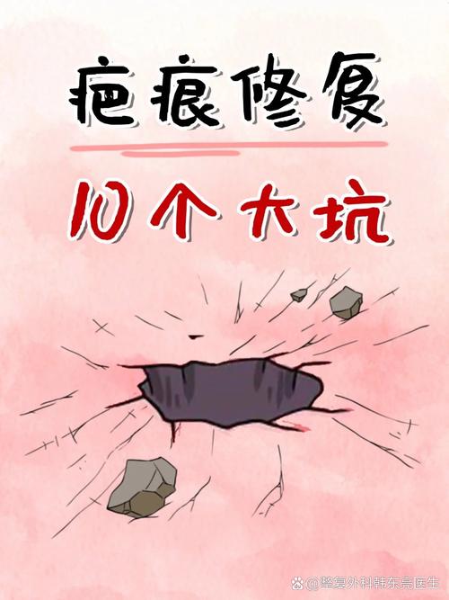 这些隐形坑,我替你踩过了,别再掉进去
