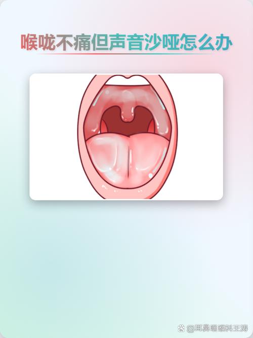 🗣️ 真实Q&A：你们常问的护嗓问题