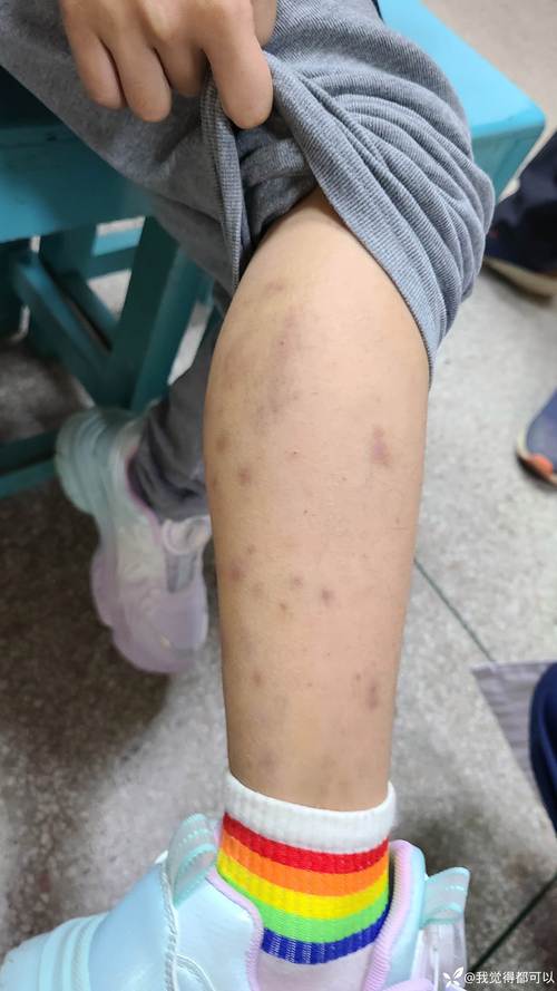 绝对不能拖的宝宝学步就医红线