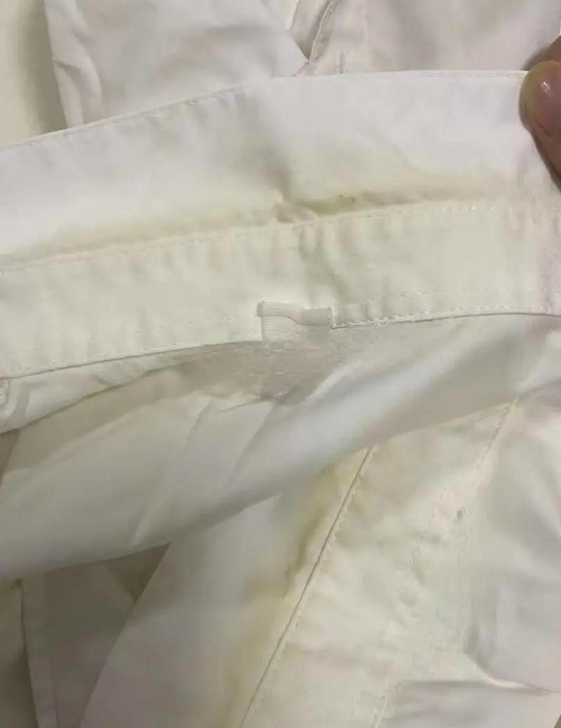 白醋浸泡发黄白色领口实拍