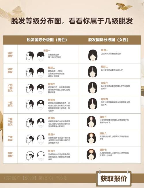 预警模型里那些让你头秃的参数