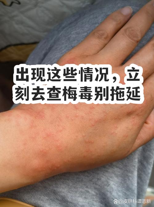 出现这些情况，别硬扛，去查一查