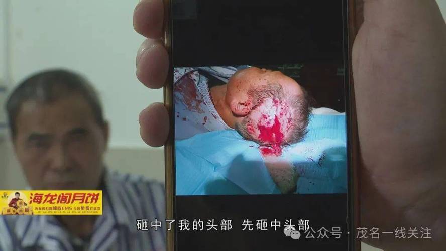 路人被高空抛物砸伤模拟图