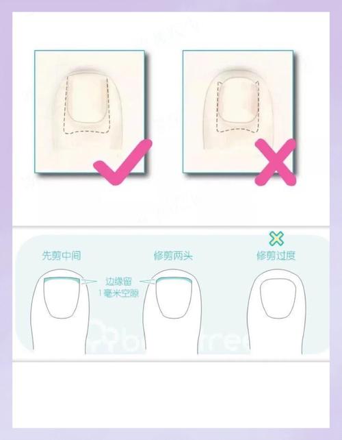 不同月龄宝宝指甲修剪安全长度对比示意图