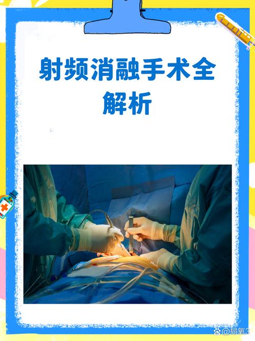 射频到底在干嘛?别被那些术语唬住