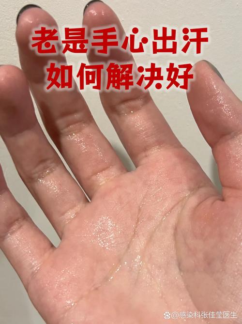 公众演讲时手心出汗的手部特写