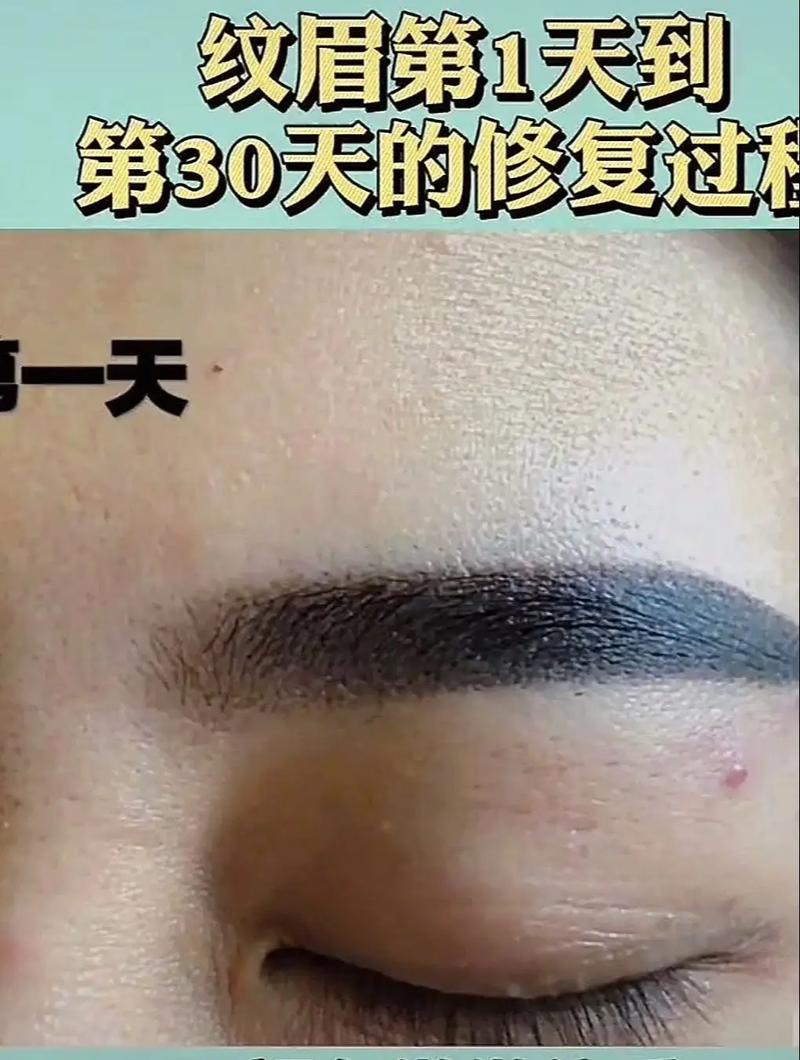 新娘半永久纹眉恢复期红肿照片