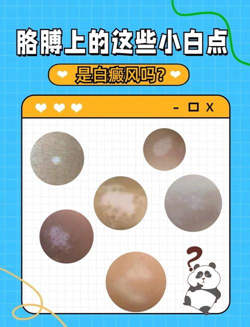 特殊情况和小白误区