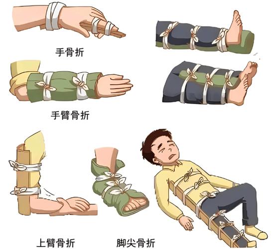 在家练怎么搭建一个“防受伤系统”？