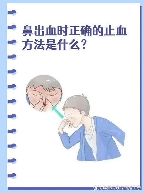 流鼻血前倾捏鼻翼正确姿势示意图