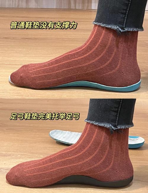 跟腱炎适配鞋垫足部受力对比图