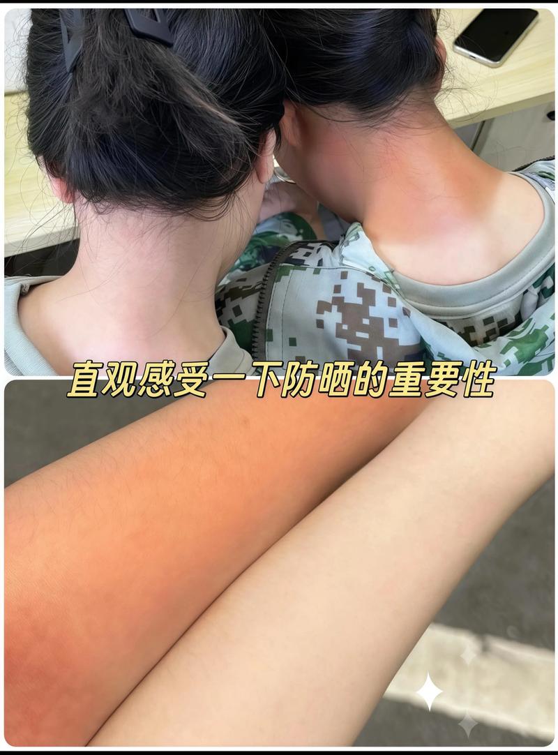 海边沙滩防晒霜补涂后颈示意图