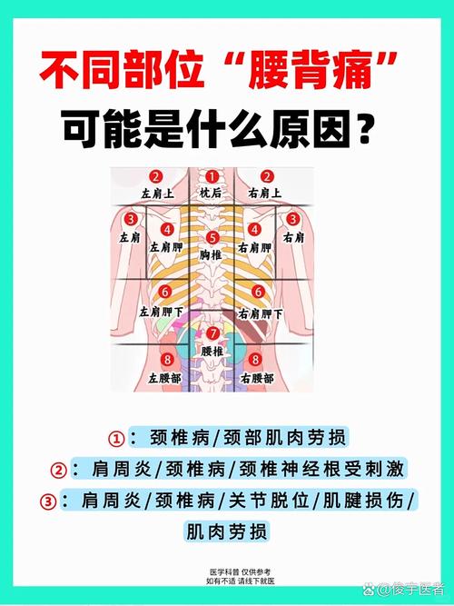 压力导致身体疼痛区域示意图