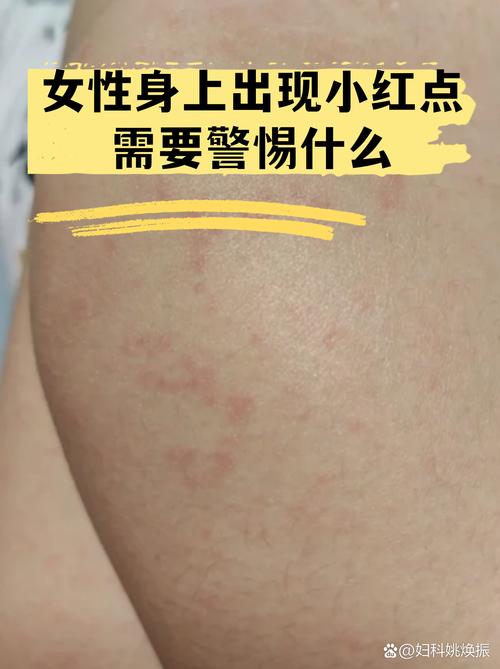 几个容易忽略的小卡点