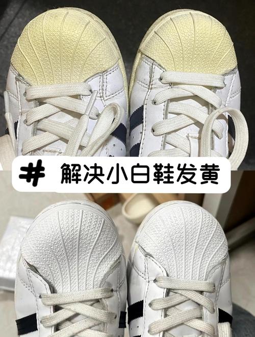小白鞋发黄怎么洗白?这些清洁妙招让你告别烦恼-我问答网