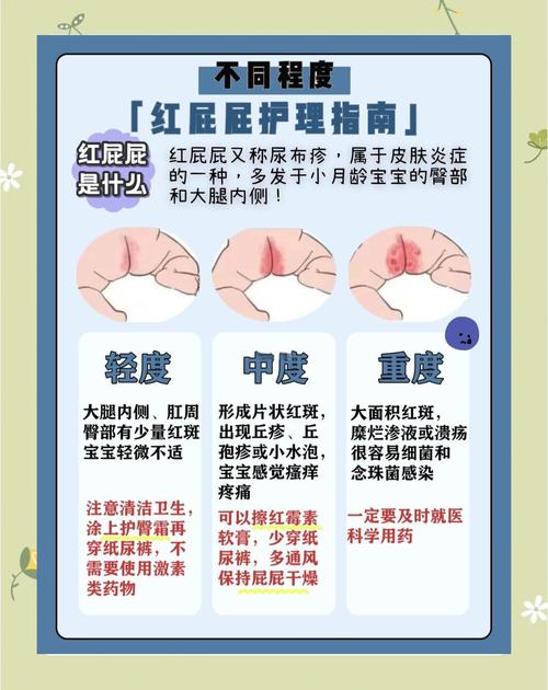 不同严重程度婴儿红臀护理方案对比图