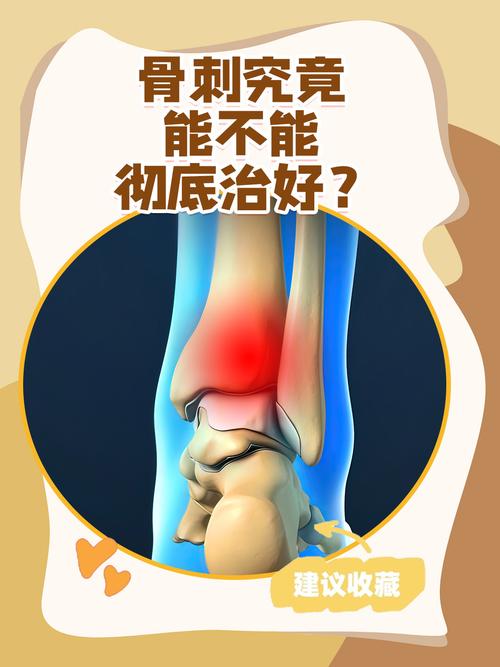 三、骨头里挑刺:那些最易忽略的关键