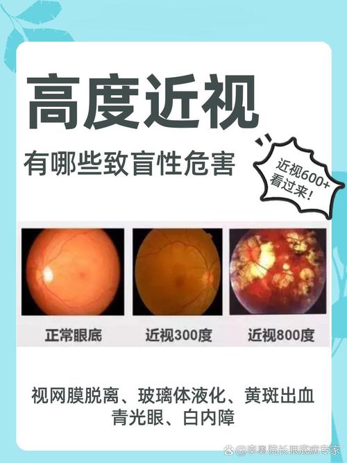 自然教育：从后院开始的终身课堂-超级宝贝
