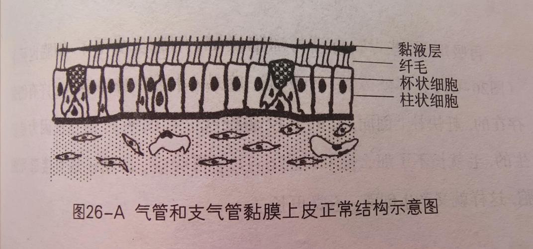 人体呼吸道黏膜纤毛清洁功能示意图