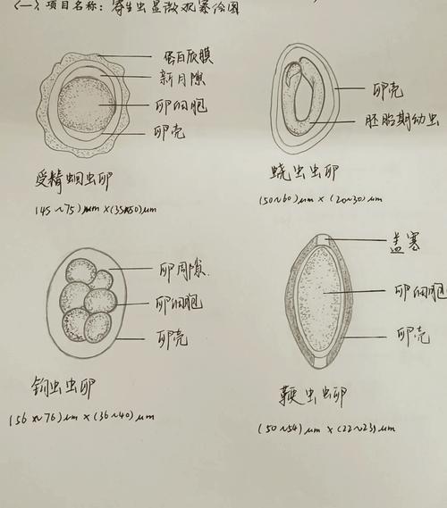 蜗牛,慢吞吞的生存艺术家-因为所以