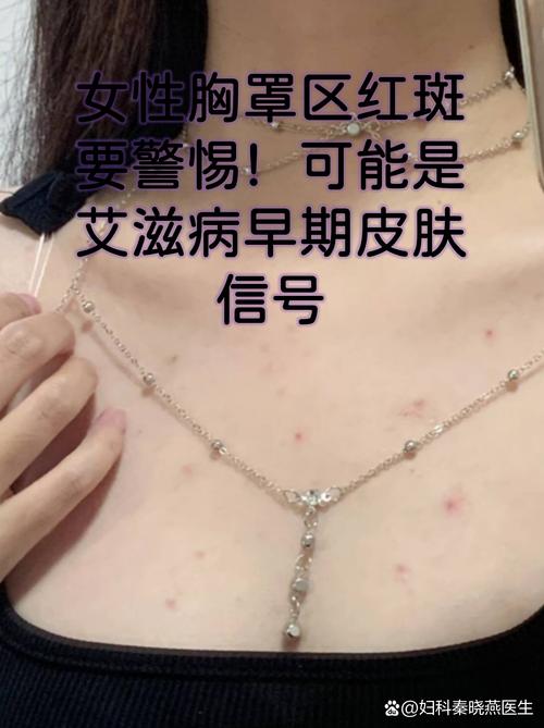 必须就医的青春期前兆危险红线