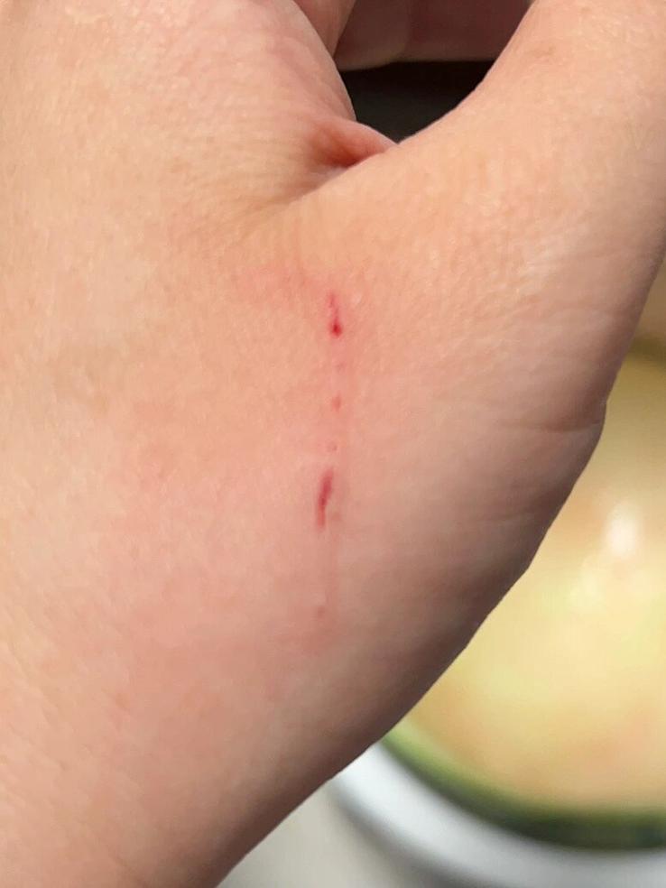 新手用手逗猫被抓出的血印