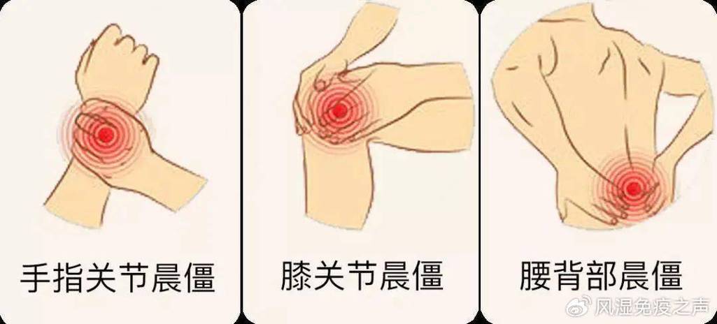 晨起关节发僵分部位预热动作示意图