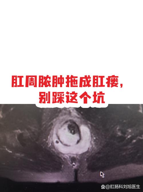 这些坑踩了,本来轻度的病也能拖成要开刀
