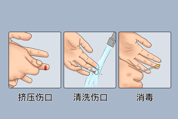 工业化学品灼伤清水冲洗操作示范图