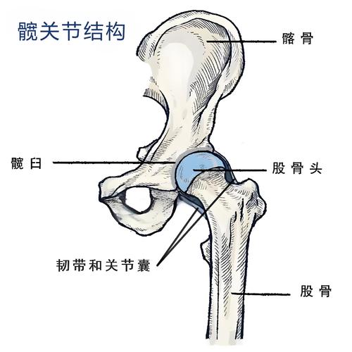 犬髋关节正常结构与发育不良结构对比解剖示意图