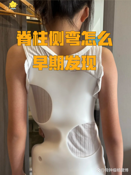 青少年向前弯腰90度背部不对称表现实拍图