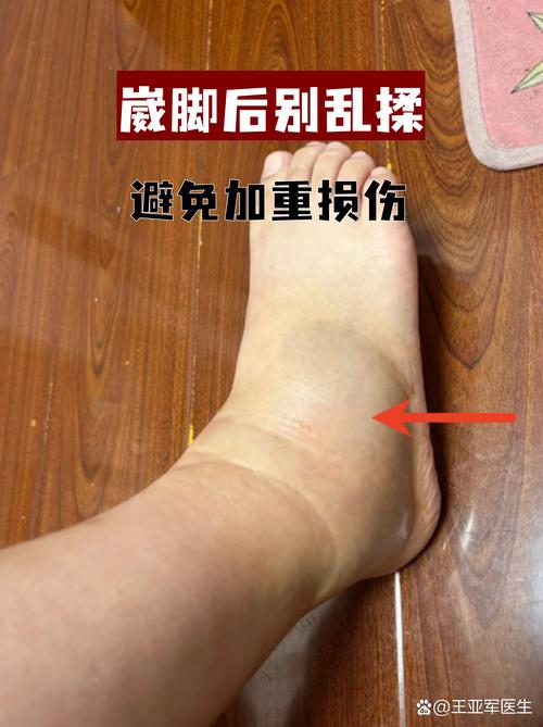 急性扭伤别乱揉,很多人第一步就错了