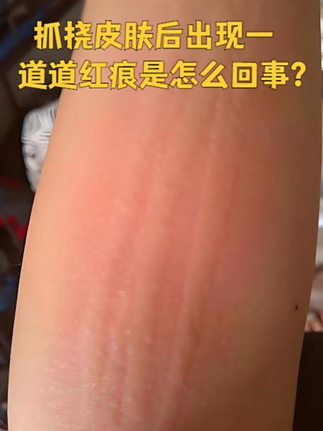 碰爬虫的，记住这三条红线就够了