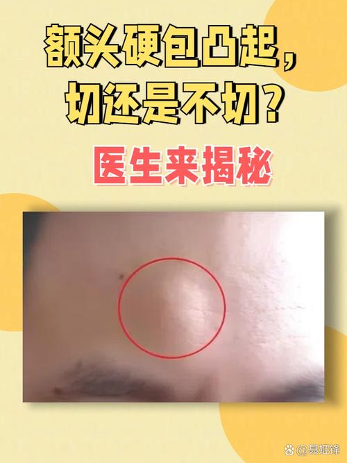 住进去才懂的硬包真相