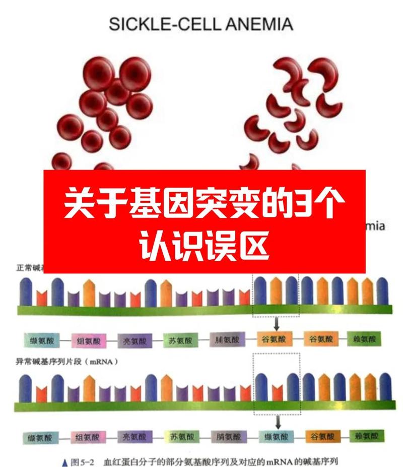 四、实例说事:一个基因改变一种病